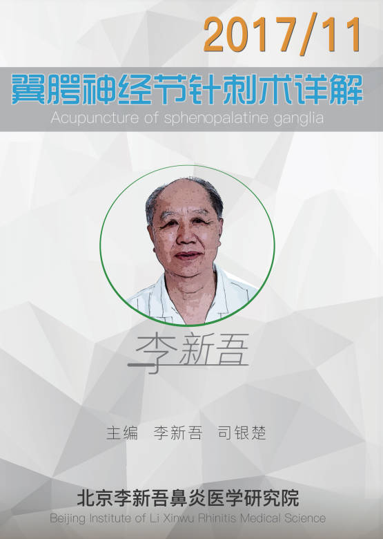 翼腭神经节针刺术详解北京李新吾鼻炎医学研究院