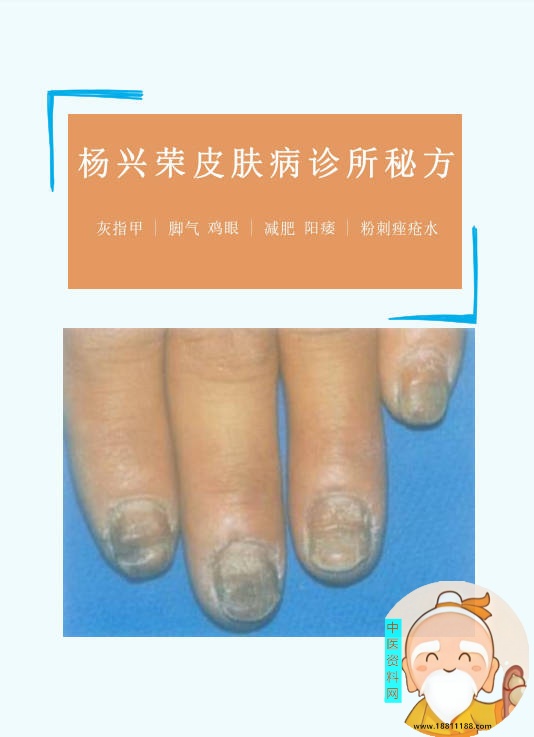 杨兴荣皮肤病诊所秘方
